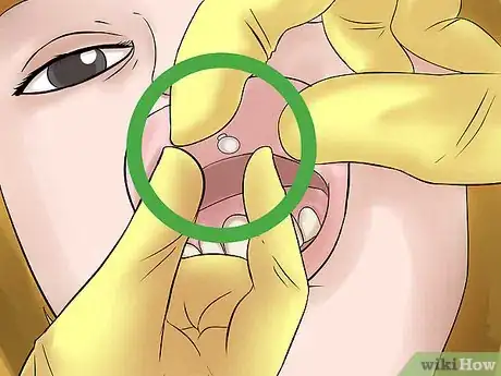 Image titled Take Out a Monroe Piercing Step 6