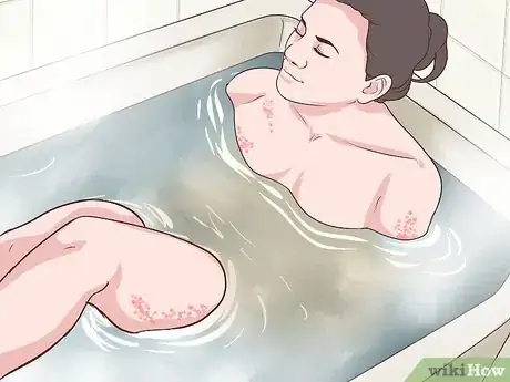 Image titled Soothe Psoriasis Itching Step 3