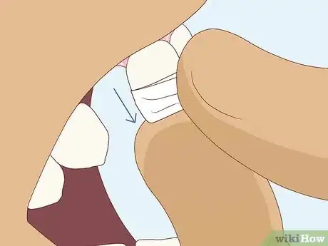 Image titled Pull a Loose Tooth at Home Step 3