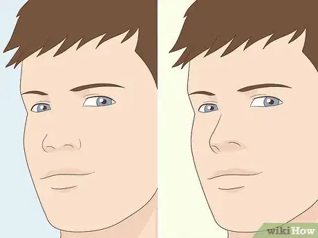 Image titled Have Plastic Surgery Step 2