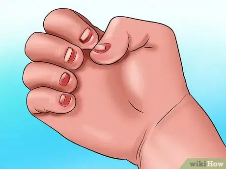 Image titled Stop Children from Biting Their Fingernails Step 16