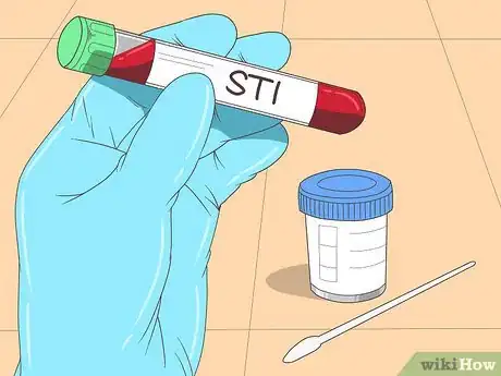 Image titled Cure Balanitis Step 10