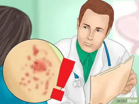 Image titled Prevent Staph Blood Infections Step 4