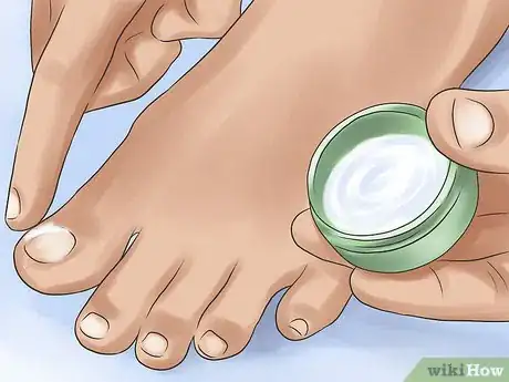 Image titled Keep Your Nails Healthy Step 1