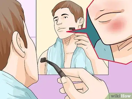 Image titled Know if You Have Sensitive Skin Step 4