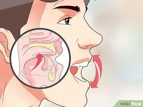 Image titled Do Exercises for TMJ Treatment Step 4