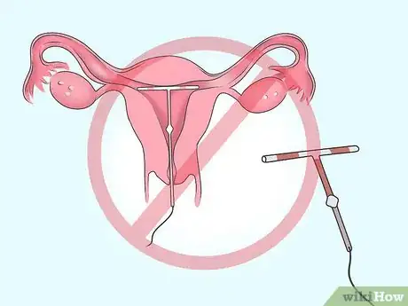 Image titled Prevent Actinomycosis Step 4