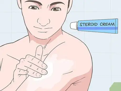 Image titled Prevent Vitiligo from Getting Worse Step 6