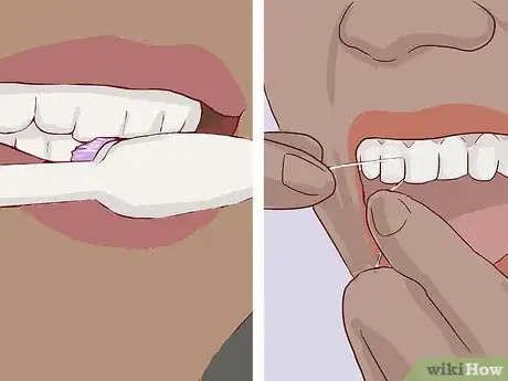 Image titled Know What to Expect when Getting a Tooth Implant Step 18
