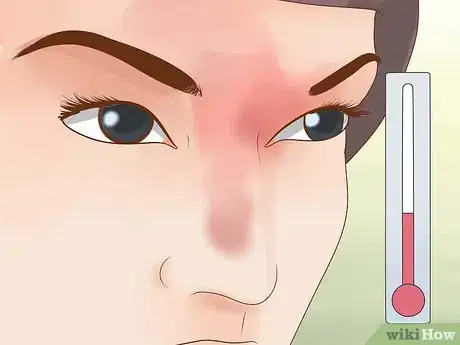 Image titled Prevent Frostbite Step 3