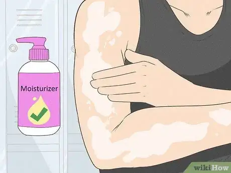 Image titled Thicken Skin Step 1