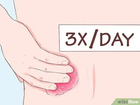 Image titled Use Cayenne for Back Pain Step 7