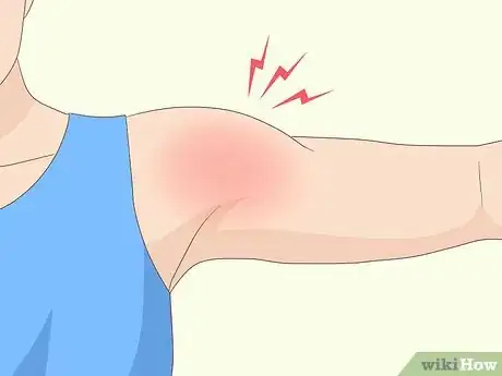Image titled Identify a Rotator Cuff Injury Step 4