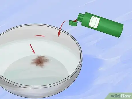 Image titled Use Foot Baths for Athlete’s Foot Step 16