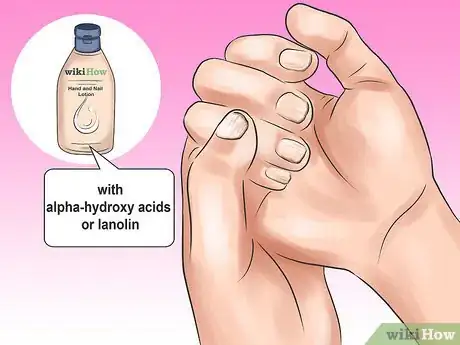 Image titled Keep Your Nails Healthy Step 2