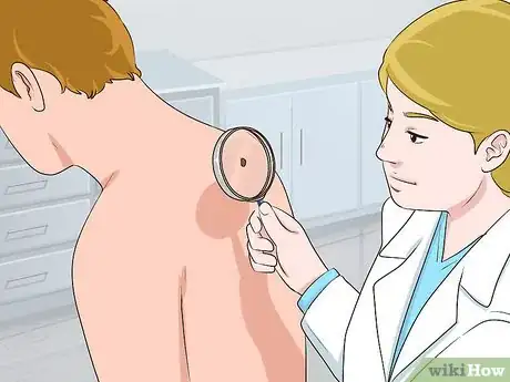 Image titled Undergo a Mole Biopsy Step 12
