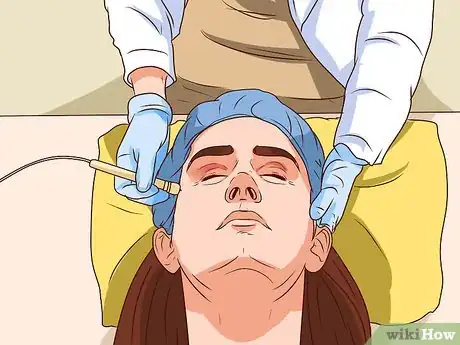 Image titled Get Collagen Induction Therapy Step 6