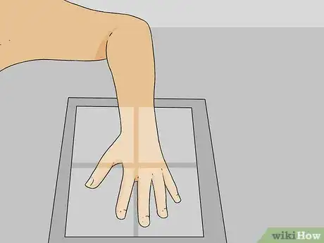 Image titled Diagnose a Broken Thumb Step 8