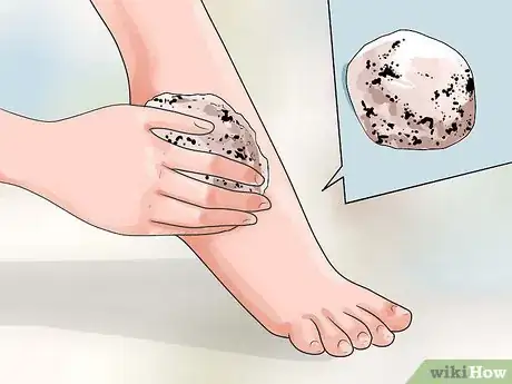 Image titled Heal Dry Skin on Your Feet Step 3