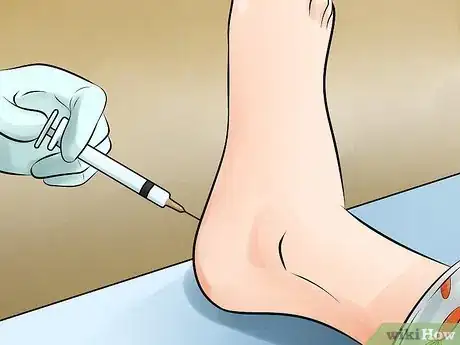 Image titled Recognize Plantar Fasciitis Symptoms Step 17