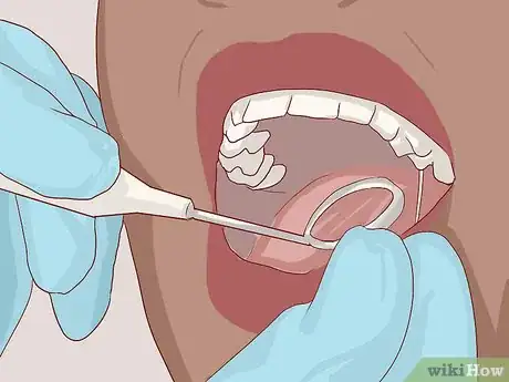 Image titled Know What to Expect when Getting a Tooth Implant Step 11
