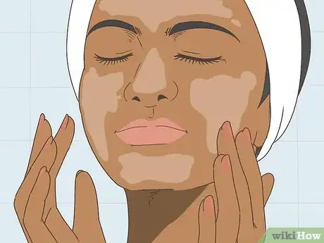 Image titled Buy a Dermaroller Step 14