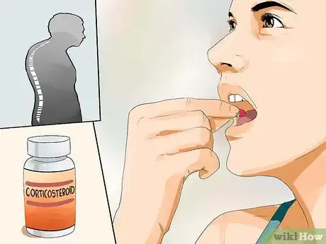 Image titled Reduce Eczema Itching Step 16