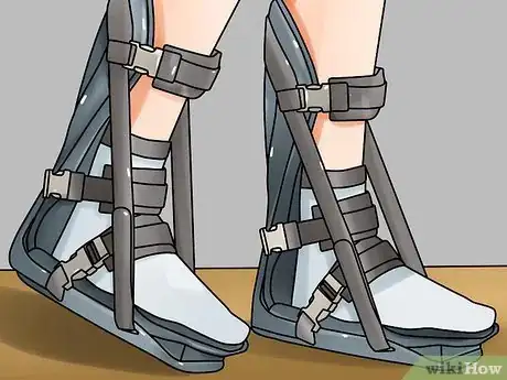 Image titled Recognize Plantar Fasciitis Symptoms Step 20