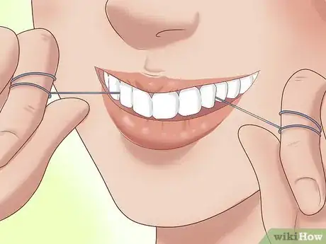 Image titled Have the Perfect Smile Step 8