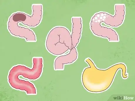 Image titled Walk a Colicking Horse Step 9