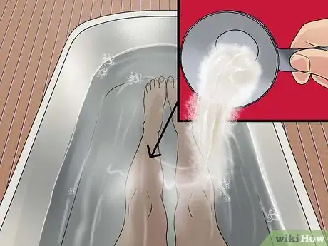 Image titled Prevent Shin Splints Step 6