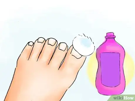 Image titled Get Perfect Feet for Summer Step 10