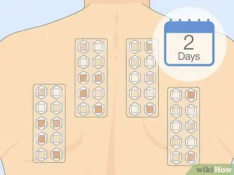 Image titled Patch Test Skin Step 7