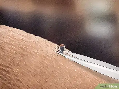 Image titled Remove a Tick from a Horse Step 2
