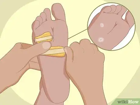 Image titled Use Bananas Step 19