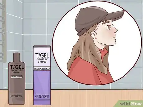 Image titled Get Rid of Dandruff at Home Step 3