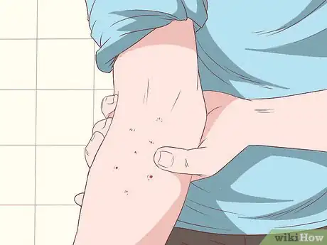 Image titled Detect Drug Use Step 5