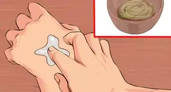 Treat Acne Scars with Aloe Vera