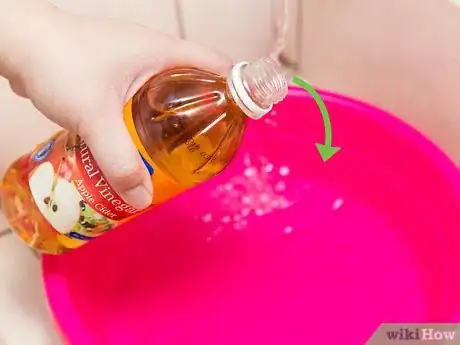 Image titled Prevent and Treat Dandruff Step 6