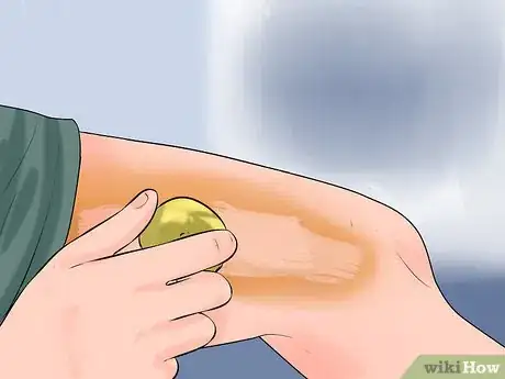 Image titled Use Lemon Juice in Your Beauty Routine Step 3