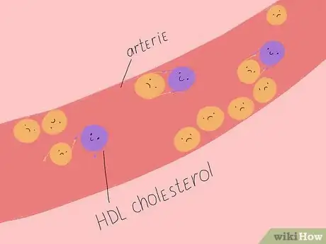 Image titled Understand the Difference Between HDL and LDL Cholesterol Step 3
