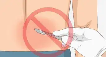 Treat a Strained Lower Back