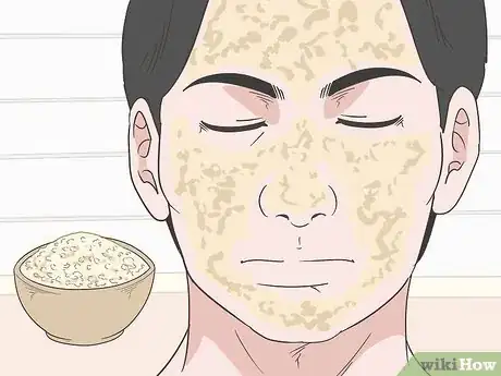 Image titled How to Treat Rosacea Can Herbal Remedies Help Step 9
