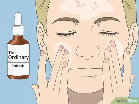 Image titled Get Rid of Acne if You Have Fair Skin Step 5