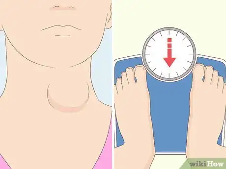 Image titled Support a Family Member Who Has Graves' Disease Step 1