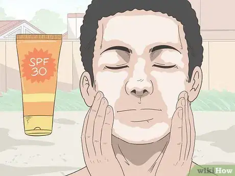 Image titled Diagnose and Treat Facial Vitiligo Step 14
