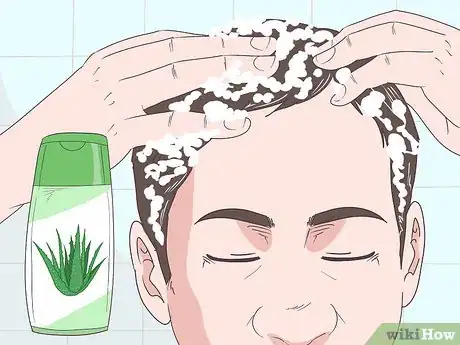 Image titled Make Your Hairline Grow Back Step 2