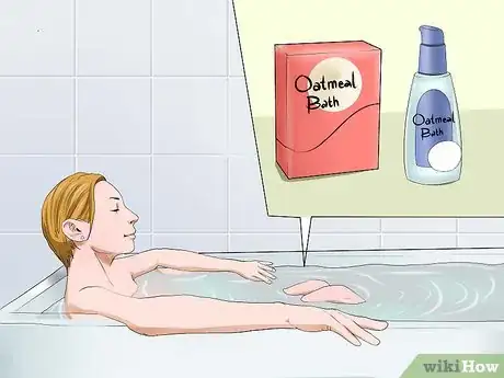 Image titled Get Rid of a Rash Between Your Legs Step 11