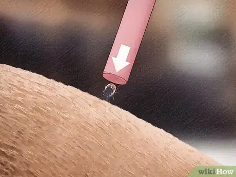 Image titled Remove a Tick from a Horse Step 4