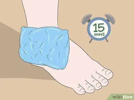 Image titled Treat Syndesmosis Step 2